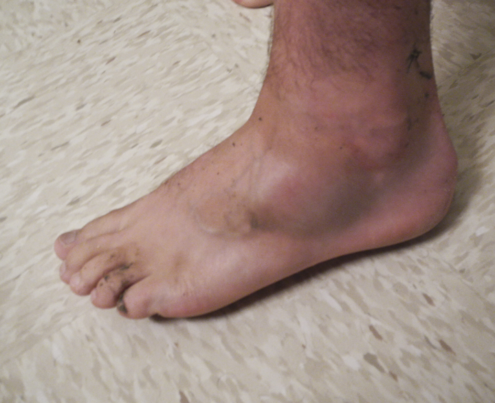8673-Fly Fishing Rocky Mountain National Park-Almost snapped my ankle off in a 4 foot muskrat hole…ouch
